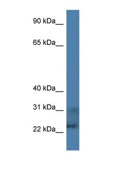 TNFSF9 / CD137L Antibody - TNFSF9 antibody western blot of HepG2 Cell lysate. Antibody concentration 1 ug/ml.  This image was taken for the unconjugated form of this product. Other forms have not been tested.