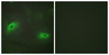 TNFSF9 / CD137L Antibody - Immunofluorescence analysis of HeLa cells, using TNFSF9 Antibody. The picture on the right is blocked with the synthesized peptide.