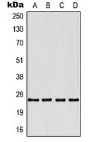 TNFSF9 / CD137L Antibody - Western blot analysis of CD137L expression in HeLa (A); SP2/0 (B); H9C2 (C); rat liver (D) whole cell lysates.