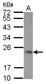 TNFSF9 / CD137L Antibody - Sample (30 ug of whole cell lysate) A: HCT116 12% SDS PAGE GTX17355 diluted at 1:1000