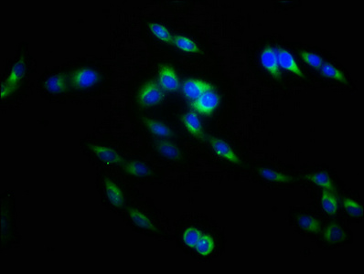 TNFSF9 / CD137L Antibody - Immunofluorescence staining of Hela cells with TNFSF9 Antibody at 1:133, counter-stained with DAPI. The cells were fixed in 4% formaldehyde, permeabilized using 0.2% Triton X-100 and blocked in 10% normal Goat Serum. The cells were then incubated with the antibody overnight at 4°C. The secondary antibody was Alexa Fluor 488-congugated AffiniPure Goat Anti-Rabbit IgG(H+L).