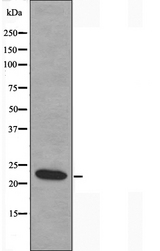 TNFSF9 / CD137L Antibody - Western blot analysis of extracts of HuvEc cells using TNFSF9 antibody.