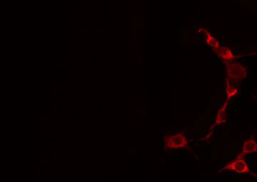TNFSF9 / CD137L Antibody - Staining HuvEc cells by IF/ICC. The samples were fixed with PFA and permeabilized in 0.1% Triton X-100, then blocked in 10% serum for 45 min at 25°C. The primary antibody was diluted at 1:200 and incubated with the sample for 1 hour at 37°C. An Alexa Fluor 594 conjugated goat anti-rabbit IgG (H+L) Ab, diluted at 1/600, was used as the secondary antibody.
