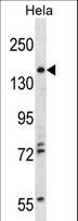 TNIK Antibody - TNIK Antibody (M1) western blot of HeLa cell line lysates (35 ug/lane). The TNIK antibody detected the TNIK protein (arrow).