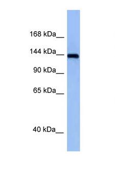 TNIK Antibody - TNIK antibody Western blot of Mouse Spleen lysate. Antibody concentration 1 ug/ml.  This image was taken for the unconjugated form of this product. Other forms have not been tested.
