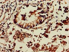 TNIK Antibody - Immunohistochemistry of paraffin-embedded human appendix tissue at dilution of 1:100