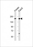 TNIK Antibody - All lanes: Anti-TNIK (S764) Antibody at 1:500 dilution Lane 1: Human brain lysate Lane 2: Caco2 whole cell lysate Lysates/proteins at 20 µg per lane. Secondary Goat Anti-Rabbit IgG, (H+L), Peroxidase conjugated at 1/10000 dilution. Predicted band size: 155 kDa Blocking/Dilution buffer: 5% NFDM/TBST.