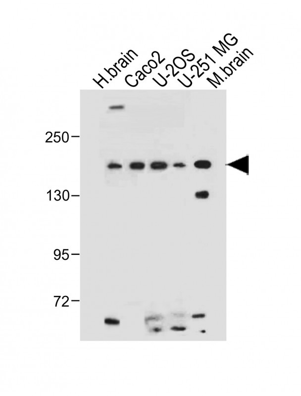 TNIK Antibody - All lanes: Anti-TNIK (S764) Antibody at 1:500 dilution Lane 1: Human brain tissue lysate Lane 2: Caco2 whole cell lysate Lane 3: U-2 OS whole cell lysate Lane 4: U-251 MG whole cell lysate Lane 5: Mouse brain tissue lysate Lysates/proteins at 20 µg per lane. Secondary Goat Anti-Rabbit IgG, (H+L), Peroxidase conjugated at 1/10000 dilution. Predicted band size: 155 kDa Blocking/Dilution buffer: 5% NFDM/TBST.