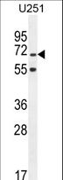 TNIP1 Antibody - TNIP1 Antibody western blot of U251 cell line lysates (35 ug/lane). The TNIP1 antibody detected the TNIP1 protein (arrow).