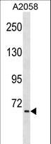 TNIP1 Antibody - TNIP1 Antibody western blot of A2058 cell line lysates (35 ug/lane). The TNIP1 antibody detected the TNIP1 protein (arrow).