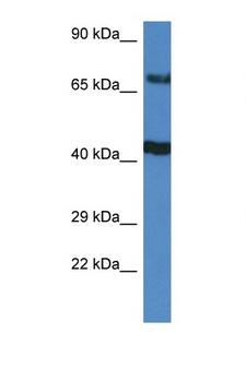TNIP1 Antibody - TNIP1 antibody Western blot of HeLa Cell lysate. Antibody concentration 1 ug/ml.  This image was taken for the unconjugated form of this product. Other forms have not been tested.