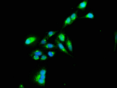 TNIP1 Antibody - Immunofluorescence staining of Hela cells at a dilution of 1:100, counter-stained with DAPI. The cells were fixed in 4% formaldehyde, permeabilized using 0.2% Triton X-100 and blocked in 10% normal Goat Serum. The cells were then incubated with the antibody overnight at 4 °C.The secondary antibody was Alexa Fluor 488-congugated AffiniPure Goat Anti-Rabbit IgG (H+L) .