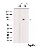 TNIP1 Antibody - Western blot analysis of extracts of 293T cells using TNIP1 antibody. The lane on the left was treated with blocking peptide.