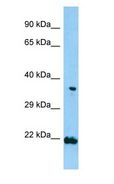 TNIP2 / ABIN-2 Antibody - TNIP2 / ABIN-2 antibody Western Blot of NCI-H226 cell lysate.  This image was taken for the unconjugated form of this product. Other forms have not been tested.
