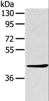 TNIP2 / ABIN-2 Antibody - Western blot analysis of A431 cell, using TNIP2 Polyclonal Antibody at dilution of 1:500.