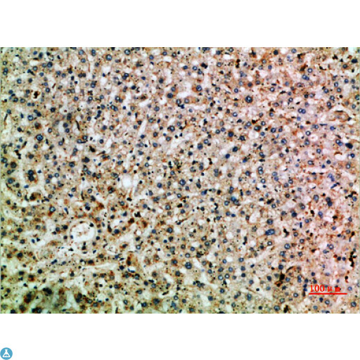 TNIP2 / ABIN-2 Antibody - Immunohistochemical analysis of paraffin-embedded human-liver, antibody was diluted at 1:200.