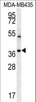 TNIP3 Antibody - TNIP3 Antibody western blot of MDA-MB435 cell line lysates (15 ug/lane). The TNIP3 antibody detected the TNIP3 protein (arrow).
