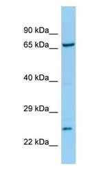 TNK1 Antibody - TNK1 antibody Western Blot of RPMI-8226 cell lysate. TNK1 is supported by BioGPS gene expression data to be expressed in RPMI 8226.  This image was taken for the unconjugated form of this product. Other forms have not been tested.