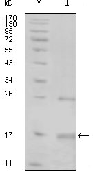 TNK1 Antibody - Western blot using TNK1 mouse monoclonal antibody against truncated TNK1-His recombinant protein (1).