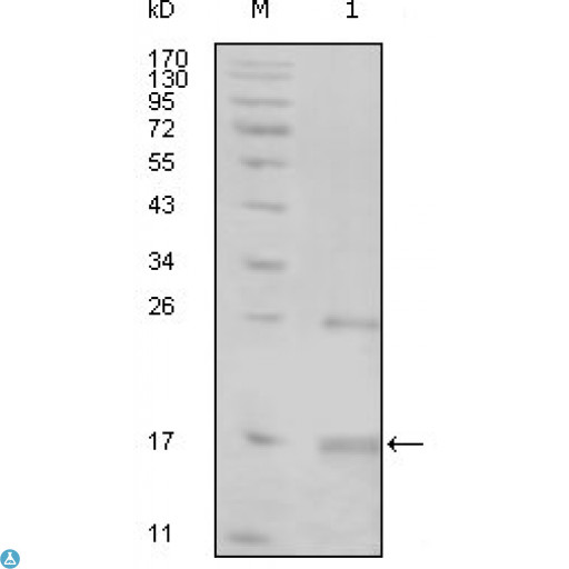 TNK1 Antibody - Western Blot (WB) analysis using TNK1 Monoclonal Antibody against truncated TNK1-His recombinant protein (1).