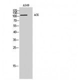 TNK2 / ACK1 Antibody - Western blot of ACK antibody