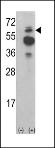 TNK2 / ACK1 Antibody - Western blot of ACK1 (arrow) using rabbit polyclonal ACK1 Antibody. 293 cell lysates (2 ug/lane) either nontransfected (Lane 1) or transiently transfected with the ACK1 gene (Lane 2) (60 KD recombinant protein).