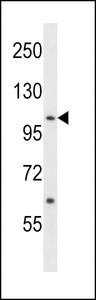 TNK2 / ACK1 Antibody - ACK1 Antibody (Center Y284) western blot of NCI-H460 cell line lysates (35 ug/lane). The ACK1 antibody detected the ACK1 protein (arrow).