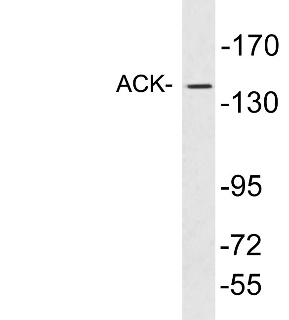 TNK2 / ACK1 Antibody - Western blot analysis of lysates from EOC20 cells, using ACK antibody.