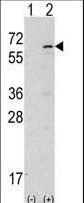 TNK2 / ACK1 Antibody - Western blot of ACK1 (arrow) using rabbit polyclonal ACK1 Antibody. 293 cell lysates (2 ug/lane) either nontransfected (Lane 1) or transiently transfected with the ACK1 gene (Lane 2) (60 KD recombinant protein).