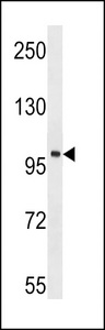 TNK2 / ACK1 Antibody - ACK1 Antibody western blot of mouse kidney tissue lysates (35 ug/lane). The ACK1 antibody detected the ACK1 protein (arrow).
