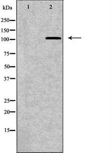 TNK2 / ACK1 Antibody - Western blot analysis of K562 whole cells lysates using TNK2 antibody. The lane on the left is treated with the antigen-specific peptide.