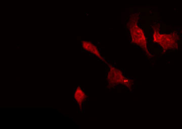 TNK2 / ACK1 Antibody - Staining HepG2 cells by IF/ICC. The samples were fixed with PFA and permeabilized in 0.1% Triton X-100, then blocked in 10% serum for 45 min at 25°C. The primary antibody was diluted at 1:200 and incubated with the sample for 1 hour at 37°C. An Alexa Fluor 594 conjugated goat anti-rabbit IgG (H+L) Ab, diluted at 1/600, was used as the secondary antibody.