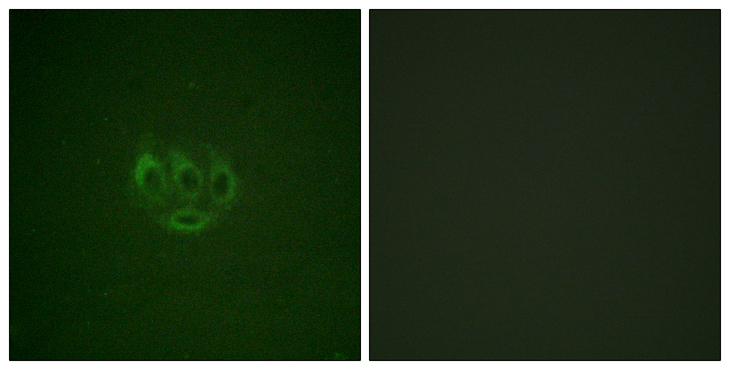 TNK2 / ACK1 Antibody - Immunofluorescence analysis of A549 cells, using ACK1 (Phospho-Tyr284) Antibody. The picture on the right is blocked with the phospho peptide.