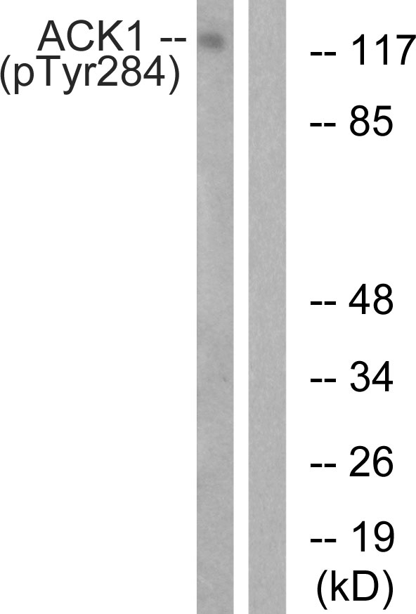 TNK2 / ACK1 Antibody - Western blot analysis of lysates from HepG2 cells treated with EGF 200ng/ml 30', using ACK1 (Phospho-Tyr284) Antibody. The lane on the right is blocked with the phospho peptide.