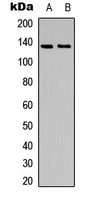 TNK2 / ACK1 Antibody - Western blot analysis of ACK1 (pY284) expression in SHSY5Y (A); HeLa (B) whole cell lysates.