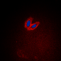 TNK2 / ACK1 Antibody - Immunofluorescent analysis of ACK1 (pY284) staining in HeLa cells. Formalin-fixed cells were permeabilized with 0.1% Triton X-100 in TBS for 5-10 minutes and blocked with 3% BSA-PBS for 30 minutes at room temperature. Cells were probed with the primary antibody in 3% BSA-PBS and incubated overnight at 4 deg C in a humidified chamber. Cells were washed with PBST and incubated with a DyLight 594-conjugated secondary antibody (red) in PBS at room temperature in the dark. DAPI was used to stain the cell nuclei (blue).