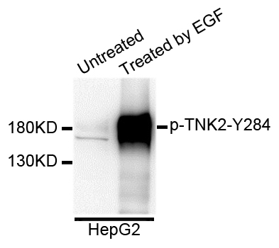 TNK2 / ACK1 Antibody - Western blot analysis of extracts of HepG2 cells.