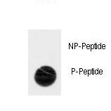 TNK2 / ACK1 Antibody - Dot blot of anti-Phospho-ACK1-pY518 Antibody on nitrocellulose membrane. 50ng of Phospho-peptide or Non Phospho-peptide per dot were adsorbed. Antibody working concentrations are 0.5ug per ml.