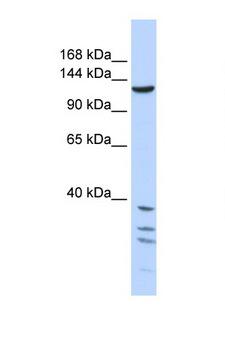 TNKS / Tankyrase Antibody - TNKS / Tankyrase antibody Western blot of 721_B Cell lysate. Antibody concentration 1 ug/ml. This image was taken for the unconjugated form of this product. Other forms have not been tested.