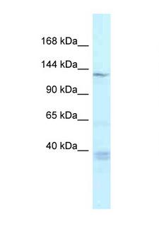TNKS / Tankyrase Antibody - TNKS / Tankyrase antibody Western blot of Rat Lung lysate. Antibody concentration 1 ug/ml.  This image was taken for the unconjugated form of this product. Other forms have not been tested.
