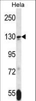 TNKS / Tankyrase Antibody - TNKS Antibody western blot of HeLa cell line lysates (35 ug/lane). The TNKS antibody detected the TNKS protein (arrow).
