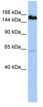 TNKS / Tankyrase Antibody - Western blot of HepG2 cell lysate.  This image was taken for the unconjugated form of this product. Other forms have not been tested.