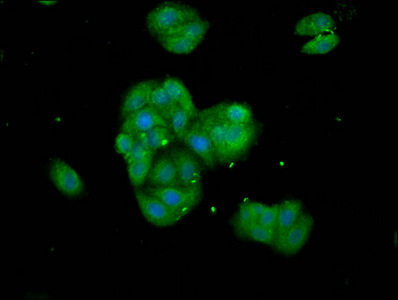 TNKS / Tankyrase Antibody - Immunofluorescence staining of HepG2 cells at a dilution of 1:133, counter-stained with DAPI. The cells were fixed in 4% formaldehyde, permeabilized using 0.2% Triton X-100 and blocked in 10% normal Goat Serum. The cells were then incubated with the antibody overnight at 4 °C.The secondary antibody was Alexa Fluor 488-congugated AffiniPure Goat Anti-Rabbit IgG (H+L) .