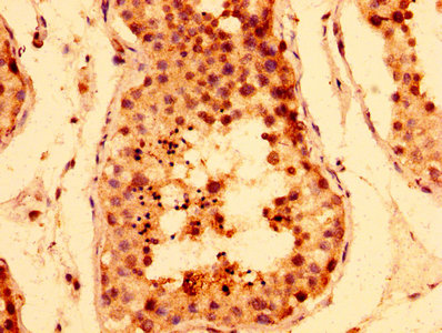 TNKS / Tankyrase Antibody - Immunohistochemistry image at a dilution of 1:400 and staining in paraffin-embedded human testis tissue performed on a Leica BondTM system. After dewaxing and hydration, antigen retrieval was mediated by high pressure in a citrate buffer (pH 6.0) . Section was blocked with 10% normal goat serum 30min at RT. Then primary antibody (1% BSA) was incubated at 4 °C overnight. The primary is detected by a biotinylated secondary antibody and visualized using an HRP conjugated SP system.