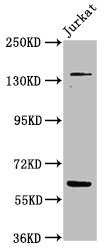 TNKS / Tankyrase Antibody - Positive Western Blot detected in Jurkat whole cell lysate. All lanes: TNKS antibody at 4.8 µg/ml Secondary Goat polyclonal to rabbit IgG at 1/50000 dilution. Predicted band size: 143, 68 KDa. Observed band size: 143, 68 KDa