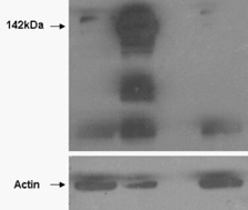 TNKS / Tankyrase Antibody - HEK293 overexpressing TANK1 (lane 2) and TANK2 (lane 4) and probed with (mock transfection in first lane). Lane three is empty. Lower panel shows the same lysates probed for alpha-Actin to show protein levels. Primary incubation (0.5ug/ml) was ove