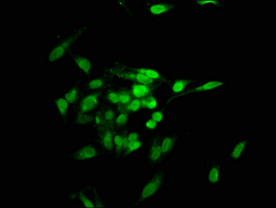 TNKS1BP1 / TAB182 Antibody - Immunofluorescence staining of Hela cells at a dilution of 1:100, counter-stained with DAPI. The cells were fixed in 4% formaldehyde, permeabilized using 0.2% Triton X-100 and blocked in 10% normal Goat Serum. The cells were then incubated with the antibody overnight at 4 °C.The secondary antibody was Alexa Fluor 488-congugated AffiniPure Goat Anti-Rabbit IgG (H+L) .