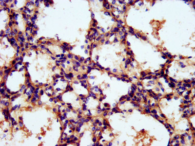 TNKS1BP1 / TAB182 Antibody - Immunohistochemistry image at a dilution of 1:300 and staining in paraffin-embedded human lung tissue performed on a Leica BondTM system. After dewaxing and hydration, antigen retrieval was mediated by high pressure in a citrate buffer (pH 6.0) . Section was blocked with 10% normal goat serum 30min at RT. Then primary antibody (1% BSA) was incubated at 4 °C overnight. The primary is detected by a biotinylated secondary antibody and visualized using an HRP conjugated SP system.