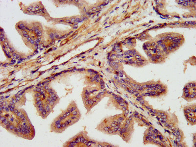 TNKS1BP1 / TAB182 Antibody - Immunohistochemistry image at a dilution of 1:300 and staining in paraffin-embedded human prostate tissue performed on a Leica BondTM system. After dewaxing and hydration, antigen retrieval was mediated by high pressure in a citrate buffer (pH 6.0) . Section was blocked with 10% normal goat serum 30min at RT. Then primary antibody (1% BSA) was incubated at 4 °C overnight. The primary is detected by a biotinylated secondary antibody and visualized using an HRP conjugated SP system.