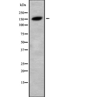 TNKS1BP1 / TAB182 Antibody - Western blot analysis of TAB182 using 293 whole cells lysates